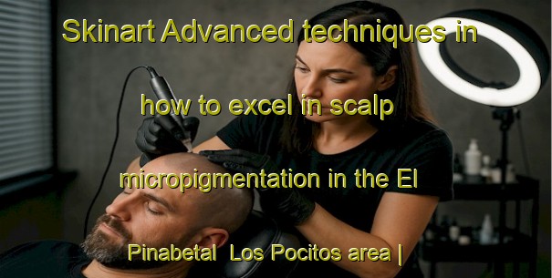 Skinart Advanced techniques in how to excel in scalp micropigmentation in the El Pinabetal  Los Pocitos area | SmpTraining | SmpClasses | SkinartTraining-Mexico